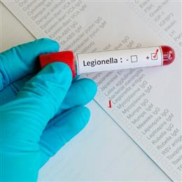 Legionella and Water Management Image